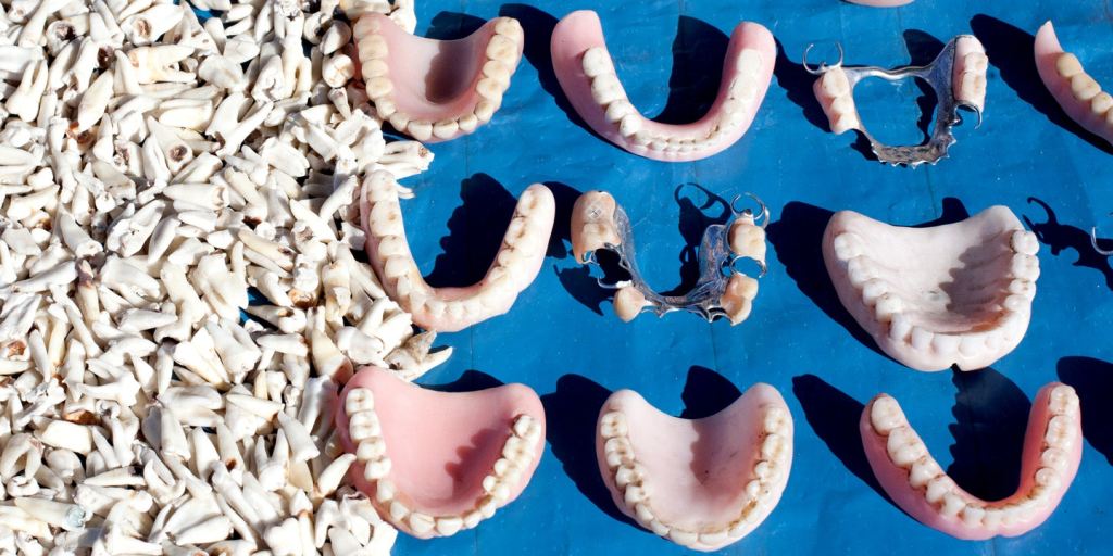 A desigualdade no Brasil é medida pelos dentes: ricos vão ao dentista, e pobres sentem&nbsp;dor