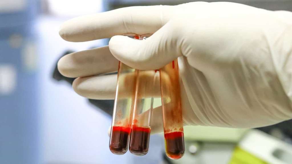 Campanha alerta para importância de diagnóstico das doenças&nbsp;autoimunes