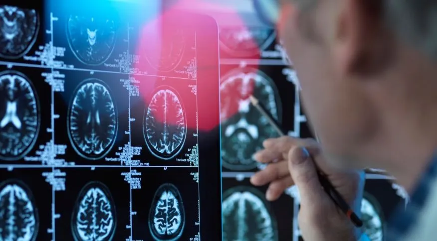 Traços da personalidade podem proteger ou envelhecer o cérebro, diz&nbsp;estudo