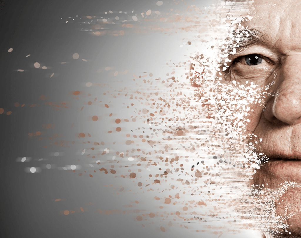 O que tem a ver inflamação com&nbsp;Alzheimer?